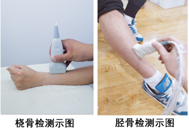 关于骨密度仪分类解析,医院体检中到底测定部位哪个部位比较安全准确