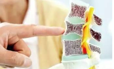 国产骨密度仪三大品牌体检的骨密度检查能不能查出骨质疏松呢