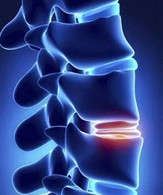GK7000便捷式骨密度检测仪的作用骨骼闭合如何二次刺激长高