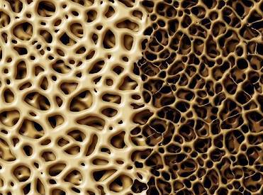 骨密度仪生产厂家为什么医生不建议测骨密度真的可以不用测吗？