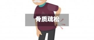 国产骨密度仪品牌排行骨质疏松常见症状和日常保健方式