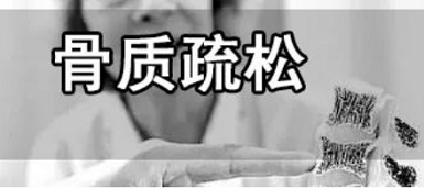 骨密度检测仪品牌X射线比超声波检测的哪个贵 两种原理的区别