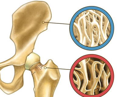 感染新冠后超声骨密度仪厂家会引发骨质疏松骨密度降低吗？
